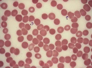 sangre con tripanosoma